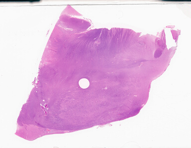 ['deident_dc9bd4e4-78d2-48b0-92d8-0dc27512a628_69d9499c.jpg']