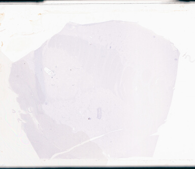 ['deident_631a60d8-ab83-47fd-81e9-d550d2806358_69d9495f.jpg']