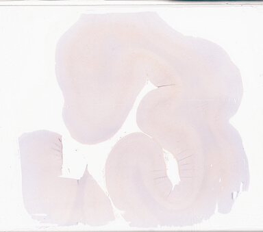 ['deident_25e284f6-232c-4bc6-9487-9b95ae5825b0_69d94933.jpg']