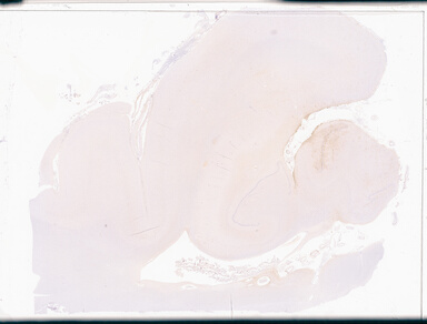['deident_8ce92d88-17e6-407c-8073-f049bc90551f_69d94972.jpg']