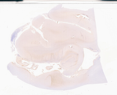 ['deident_b1597add-f870-41d4-abd9-67290fb6fbaf_69d94983.jpg']