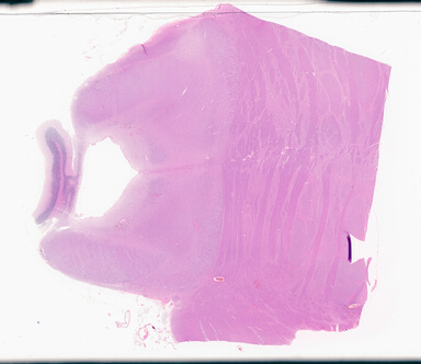 ['deident_5bd5450e-fa06-4284-9ea0-949684e13c45_69d9495b.jpg']