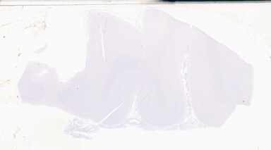 ['deident_a34a656c-0acb-4c9d-9a92-a34729527f49_69d9497a.jpg']