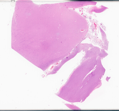 ['deident_adfabf3e-577c-43c3-9cad-6cc16745bf84_69d9497e.jpg']