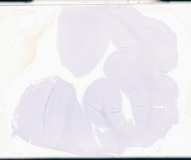 ['deident_1c35a7ab-dcd0-468c-bab6-3977ff23a0aa_69d94925.jpg']