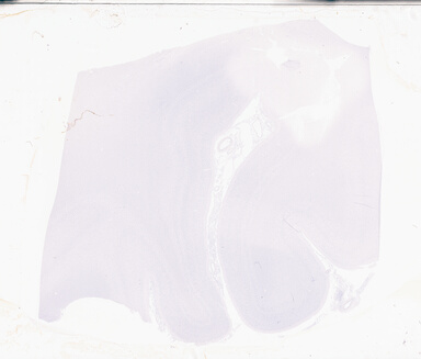 ['deident_c9c6ec54-54f8-4e90-809f-f7c6013a71fa_69d94992.jpg']