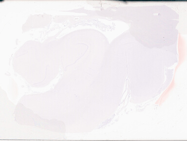 ['deident_ecdf8460-f8c0-4ef6-a323-3fffd1560462_69d9499e.jpg']