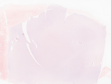 ['deident_9292d29c-f1be-447e-9bae-03601ee955af_69b052ff.jpg']