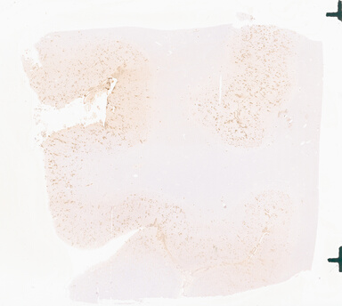 ['deident_793d9f58-393c-4949-a13f-9a8c631ec61d_69b052e7.jpg']