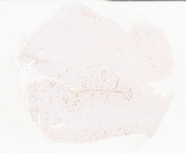 ['deident_39661f8b-054a-4dd9-9ccc-db0fc2052190_69b052da.jpg']