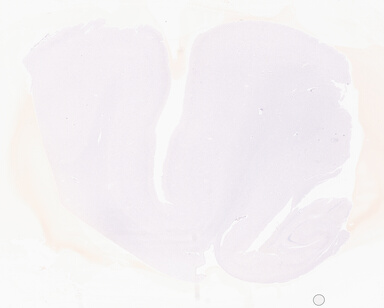 ['deident_104b48a0-0161-4de0-980c-398be758285a_69b052c7.jpg']