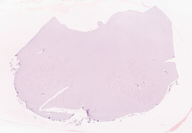 ['deident_0e7e257c-ca3d-4e18-b5c3-4739332819cc_69b052c2.jpg']