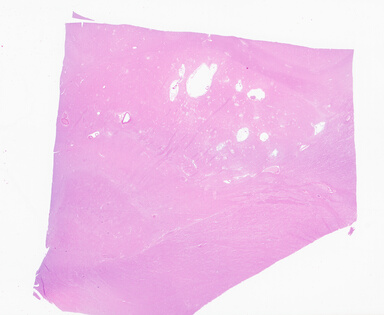 ['deident_14f8327a-455d-49ca-9116-dd67d80def80_69b052cc.jpg']