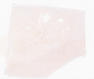 ['deident_1359a5f1-ff43-4b3f-a018-5618e878ce3e_69b052c9.jpg']