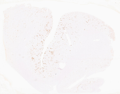['deident_6a7b6550-2ded-4ff4-8690-d9aaa2a45092_69b052e5.jpg']