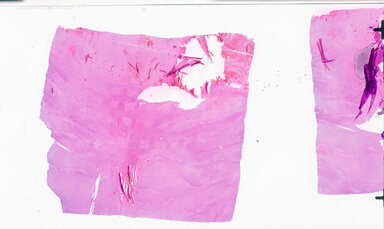 ['deident_fb9ff224-42a8-4352-a309-f2c432038eb1_69b0532a.jpg']