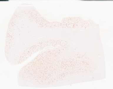 ['deident_a47f84f1-fd9b-49a0-975a-69ca38e8f170_69b05305.jpg']