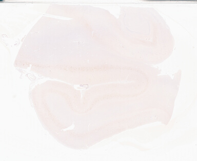 ['deident_8b58b8bb-7721-4bd3-9fc0-f707158ae3c8_69b052f5.jpg']