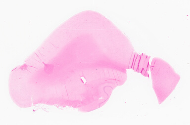 ['deident_304bd201-9373-4129-abb6-62b5afb127d7_69d9216e.jpg']