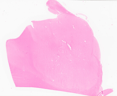 ['deident_2ed60d8e-b939-40a8-bca8-044e078e78ca_69d92169.jpg']