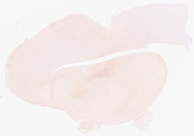 ['deident_470c4fbe-bd59-47d0-8650-357a1b0c4d00_69d92180.jpg']