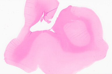['deident_f1a89169-8958-45b3-a6d1-6226ad2346d8_69d92316.jpg']