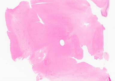 ['deident_d099a092-81f6-4dc8-9422-d7bf6c17cc3e_69d9229f.jpg']
