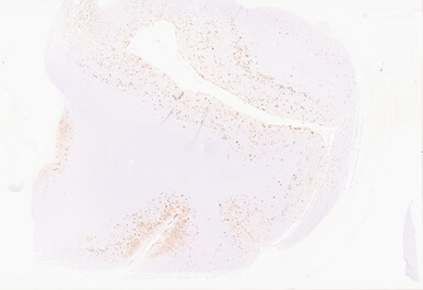 ['deident_1cd5be77-189c-45c1-91fe-704c36995a9f_69d92154.jpg']