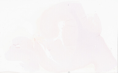 ['deident_4e6f4b1e-e1f4-4501-be29-9006c9581e06_69d92183.jpg']