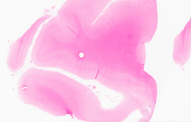 ['deident_6badcfe8-bdc7-47ec-9253-f256e3933584_69d921cc.jpg']
