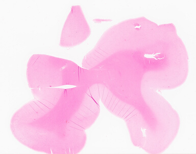 ['deident_1548f9c1-2143-4e3b-8712-c0bdebd3b67b_69d92118.jpg']
