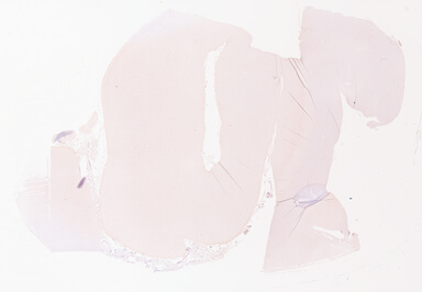 ['deident_59bd5433-257a-4841-9842-231c5f42d3c7_69d92186.jpg']