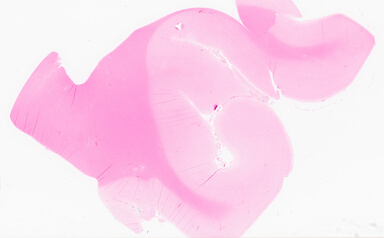 ['deident_2f1d7b2e-ec98-4de0-8b71-49e77099212c_69d9216b.jpg']