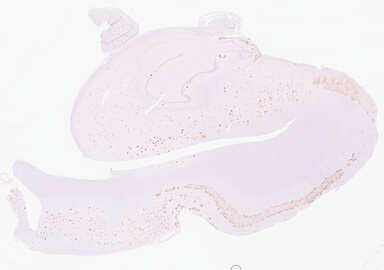 ['deident_5a1452d7-89ae-4eba-821c-fdb7e0038889_69d92189.jpg']