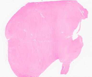 ['deident_126e2835-bf55-43db-b8dc-dcdadc1e1915_69d92114.jpg']