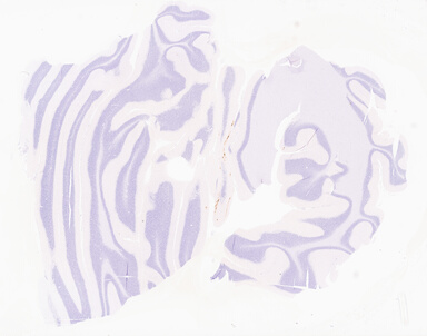 ['deident_6967f52f-9807-43f0-b3b7-92d5a879f9e6_69d921c3.jpg']