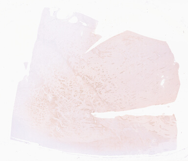 ['deident_7d89382c-4b04-41cf-9aa5-1b85c58c5af1_69d921d0.jpg']