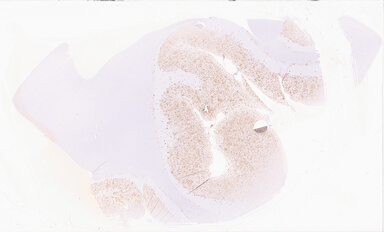 ['deident_d25d13f6-f1c2-4690-a89b-8a40183415d8_69d922c7.jpg']