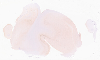 ['deident_fecb01b7-c882-4eae-aa41-79352ee9d4e0_69d92324.jpg']