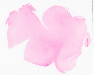 ['deident_1e3152d3-cfd4-499d-a4fc-1cff9617f76e_69d9215a.jpg']