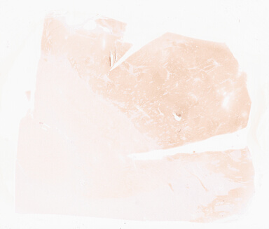 ['deident_0df0dd22-687d-4372-8272-3f59dd518c54_69d92113.jpg']