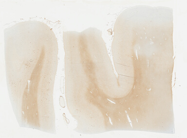 ['deident_dfcb899b-bf47-4883-af27-6112f8b3f612_69b030b3.jpg']