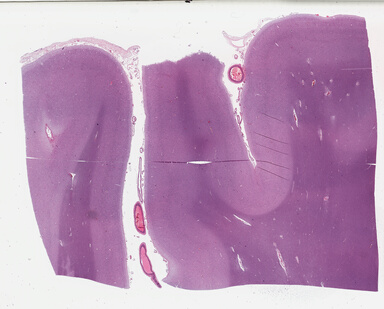 ['deident_550b78cd-6cf2-4826-b420-dc970194a83c_69b0307e.jpg']