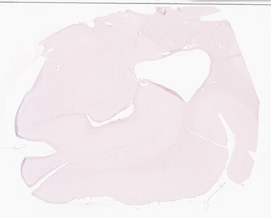 ['deident_ddd67385-f571-4e56-9bb4-714ef85c07e5_69b030b0.jpg']