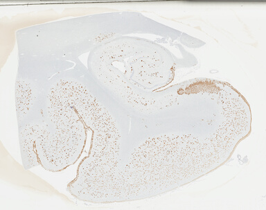 ['deident_cd910a92-a8ff-485e-92e2-3f61904b9bc5_69b030af.jpg']