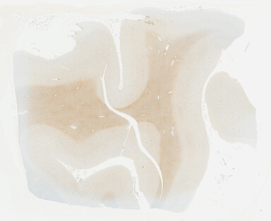 ['deident_71a9f007-74e3-45b5-98f5-13a41480f05f_69b0308f.jpg']