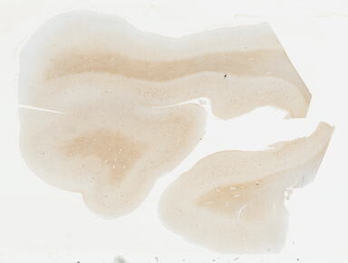 ['deident_bc7e14e5-36b6-4582-bb78-bb523eadf067_69b030a9.jpg']