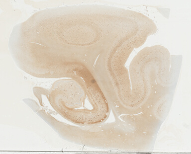 ['deident_1fbb9113-76d3-4809-bbd0-54ac7054a9fd_69b03071.jpg']