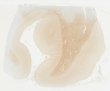['deident_b5d39c2d-e247-47aa-8b70-f3621c989a1a_69b030a5.jpg']