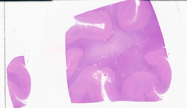 ['deident_65ec400c-ee64-44c2-b8b4-2e431d44b972_69b05135.jpg']